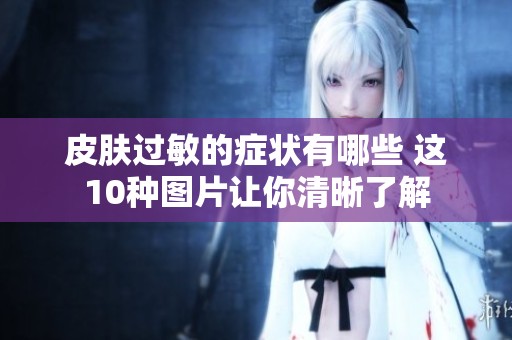 皮肤过敏的症状有哪些 这10种图片让你清晰了解